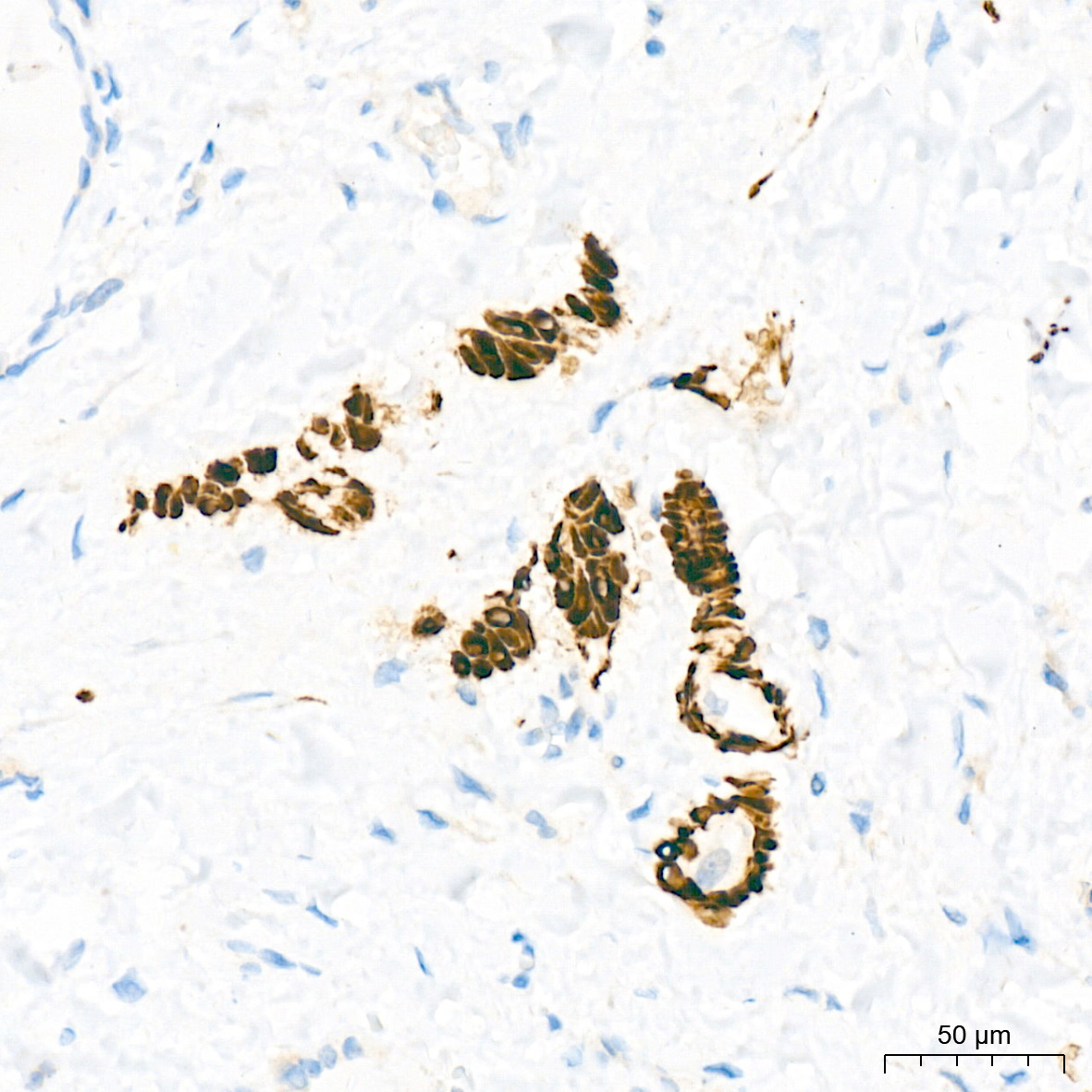 Desmin Rabbit mAb