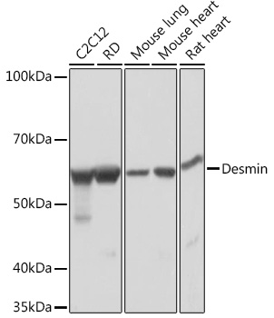 Desmin Rabbit mAb