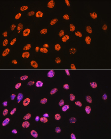 NONO/p54nrb Rabbit mAb