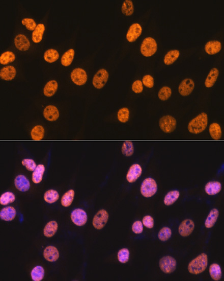NONO/p54nrb Rabbit mAb