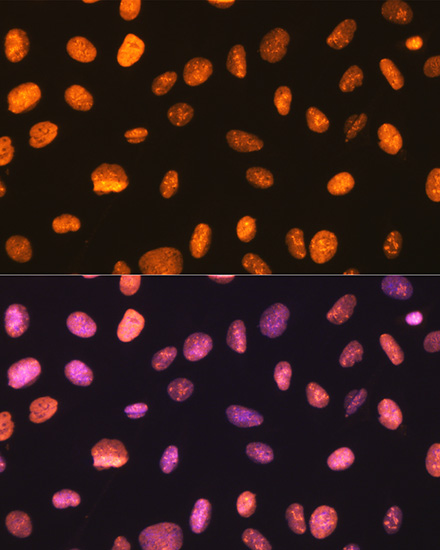 NONO/p54nrb Rabbit mAb