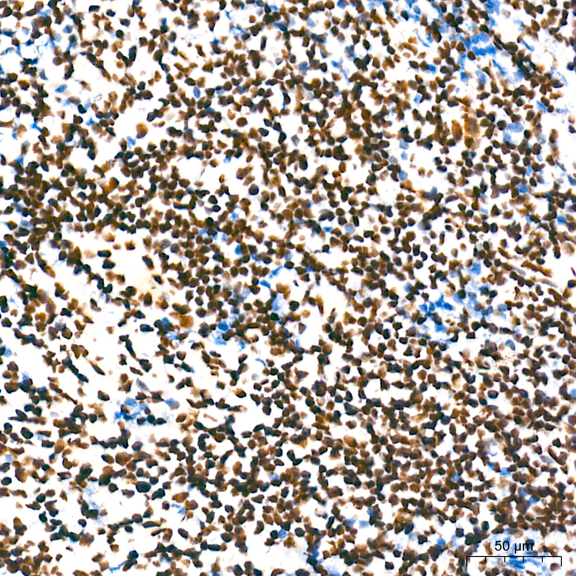 NONO/p54nrb Rabbit mAb