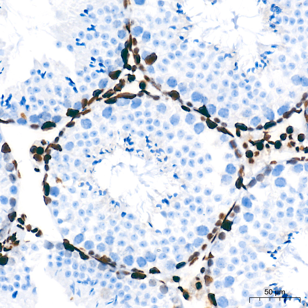 NONO/p54nrb Rabbit mAb