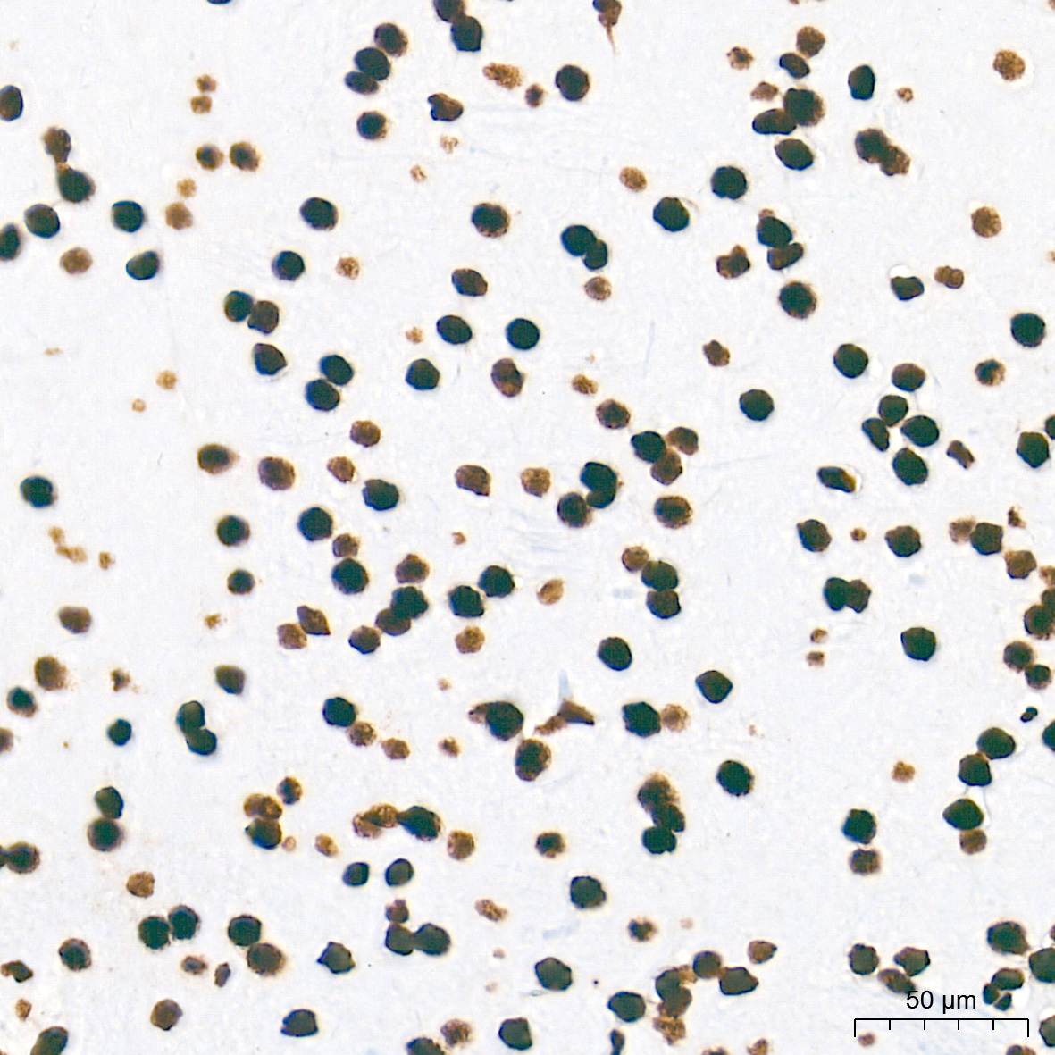 NONO/p54nrb Rabbit mAb