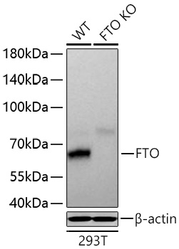 [KO Validated] FTO Rabbit mAb 
