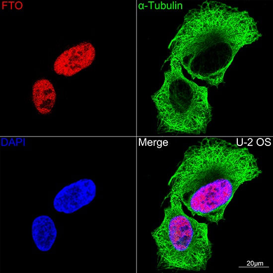 [KO Validated] FTO Rabbit mAb 