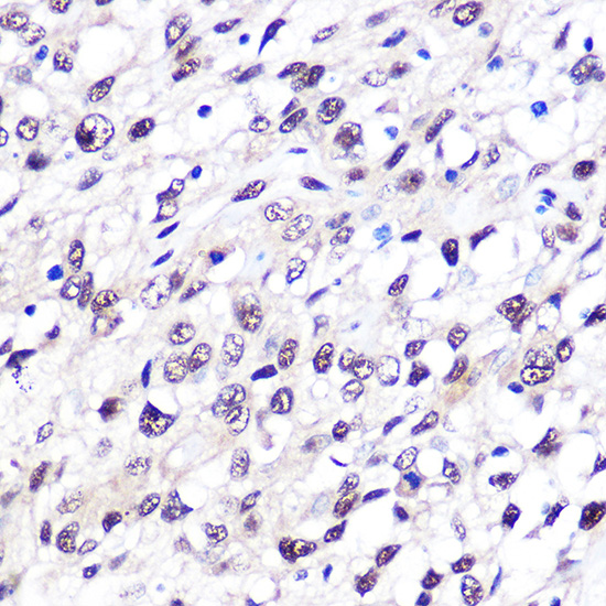 [KO Validated] FTO Rabbit mAb 
