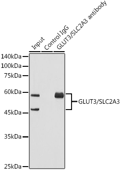 GLUT3/SLC2A3 Rabbit mAb