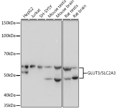 GLUT3/SLC2A3 Rabbit mAb