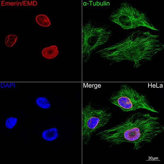 Emerin/EMD Rabbit mAb