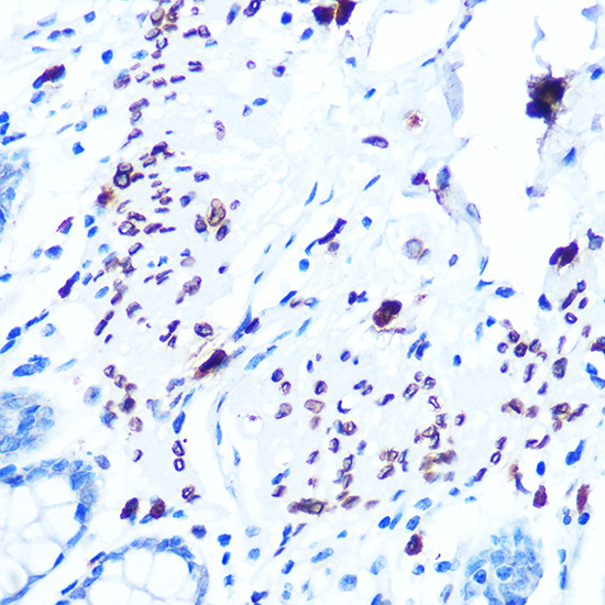 Emerin/EMD Rabbit mAb