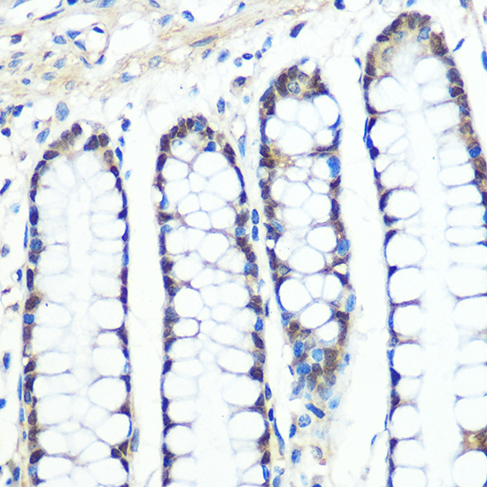 Chk1 Rabbit mAb