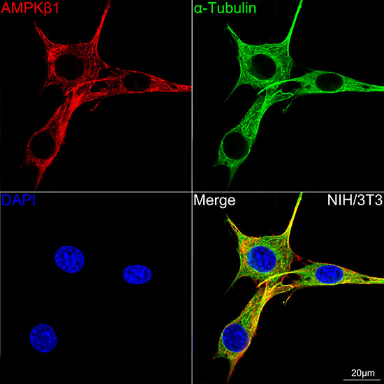 AMPKβ1 Rabbit mAb