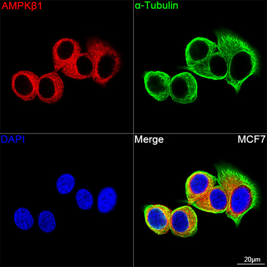 AMPKβ1 Rabbit mAb