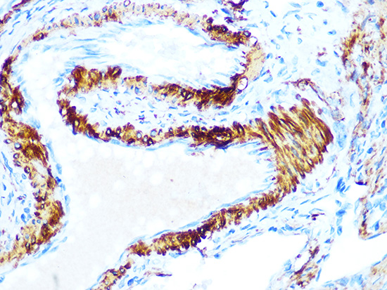 AMPKβ1 Rabbit mAb