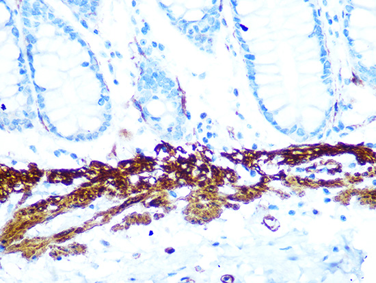 AMPKβ1 Rabbit mAb