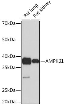 AMPKβ1 Rabbit mAb