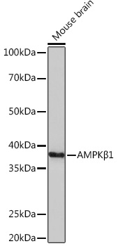 AMPKβ1 Rabbit mAb