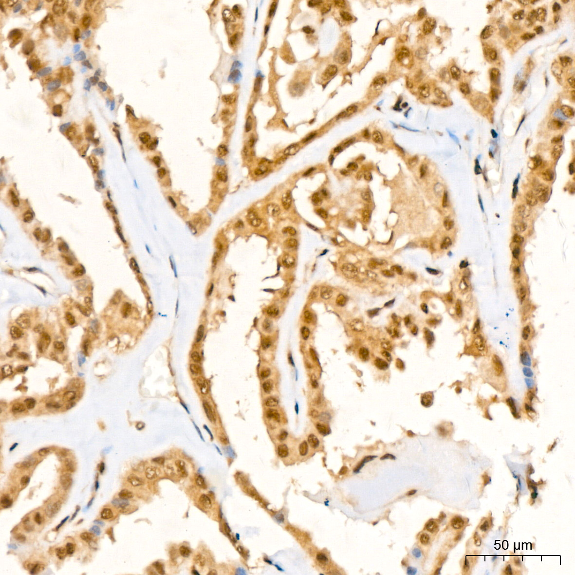 UBE2I Rabbit mAb