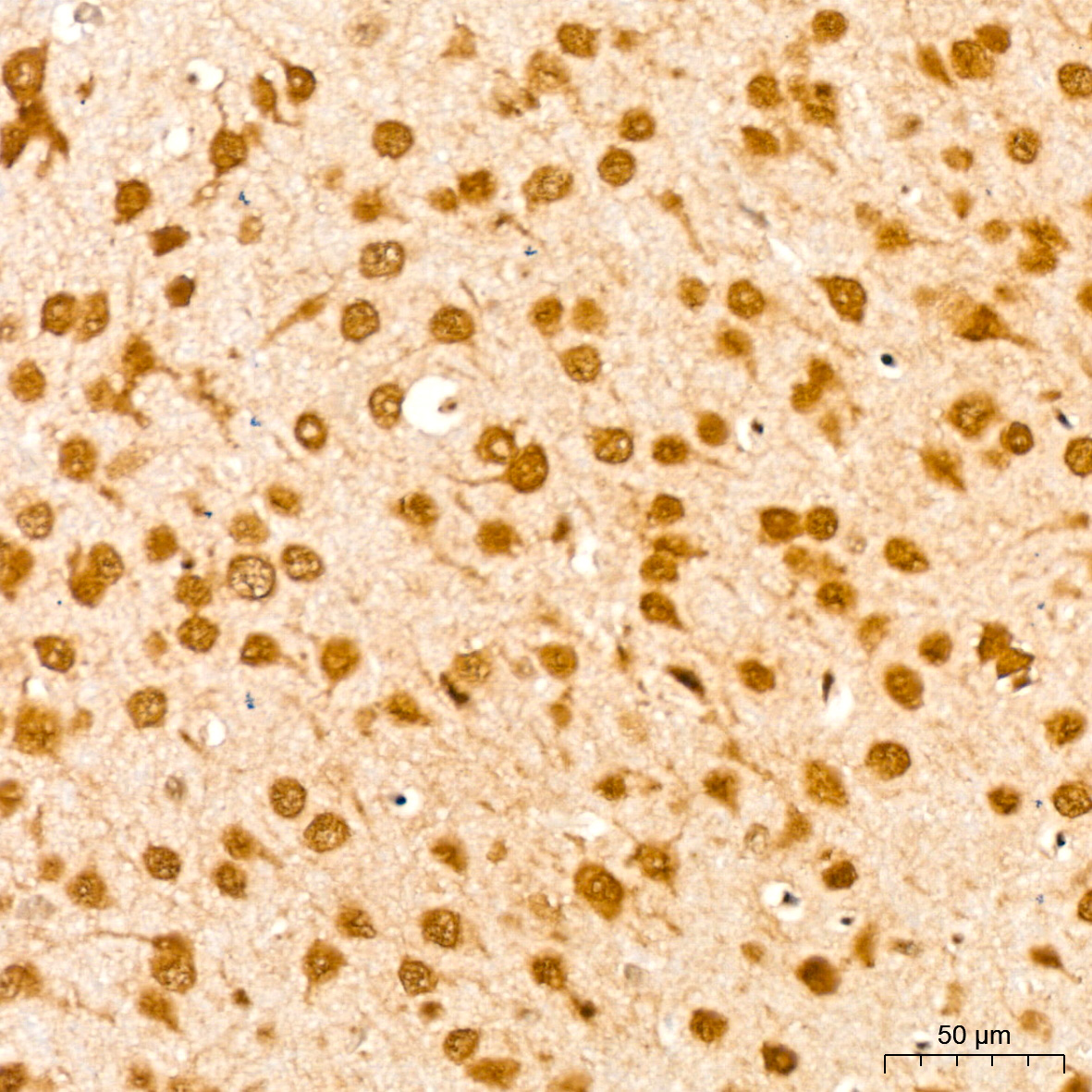 UBE2I Rabbit mAb