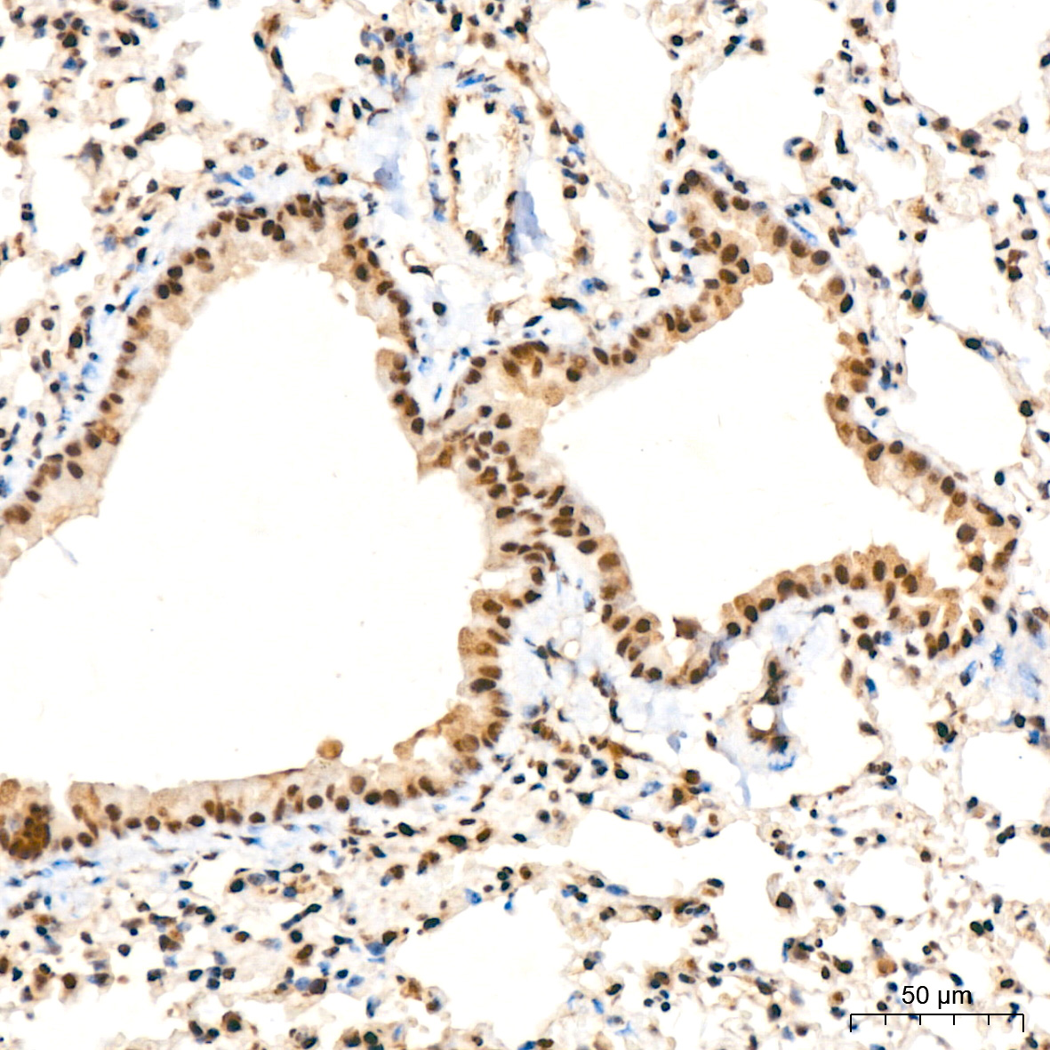 UBE2I Rabbit mAb