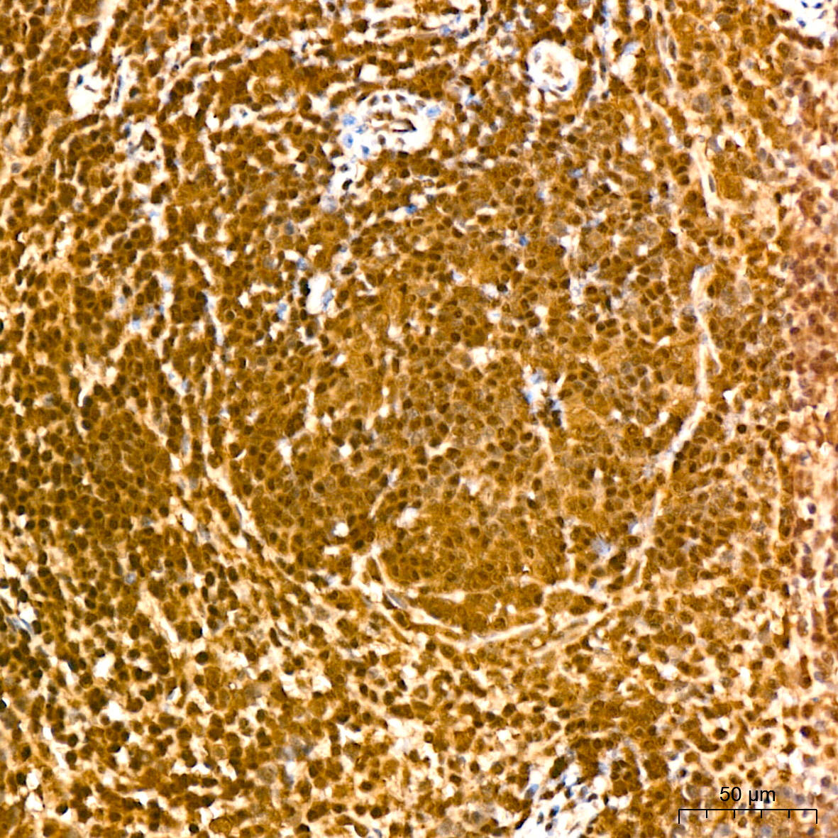 UBE2I Rabbit mAb
