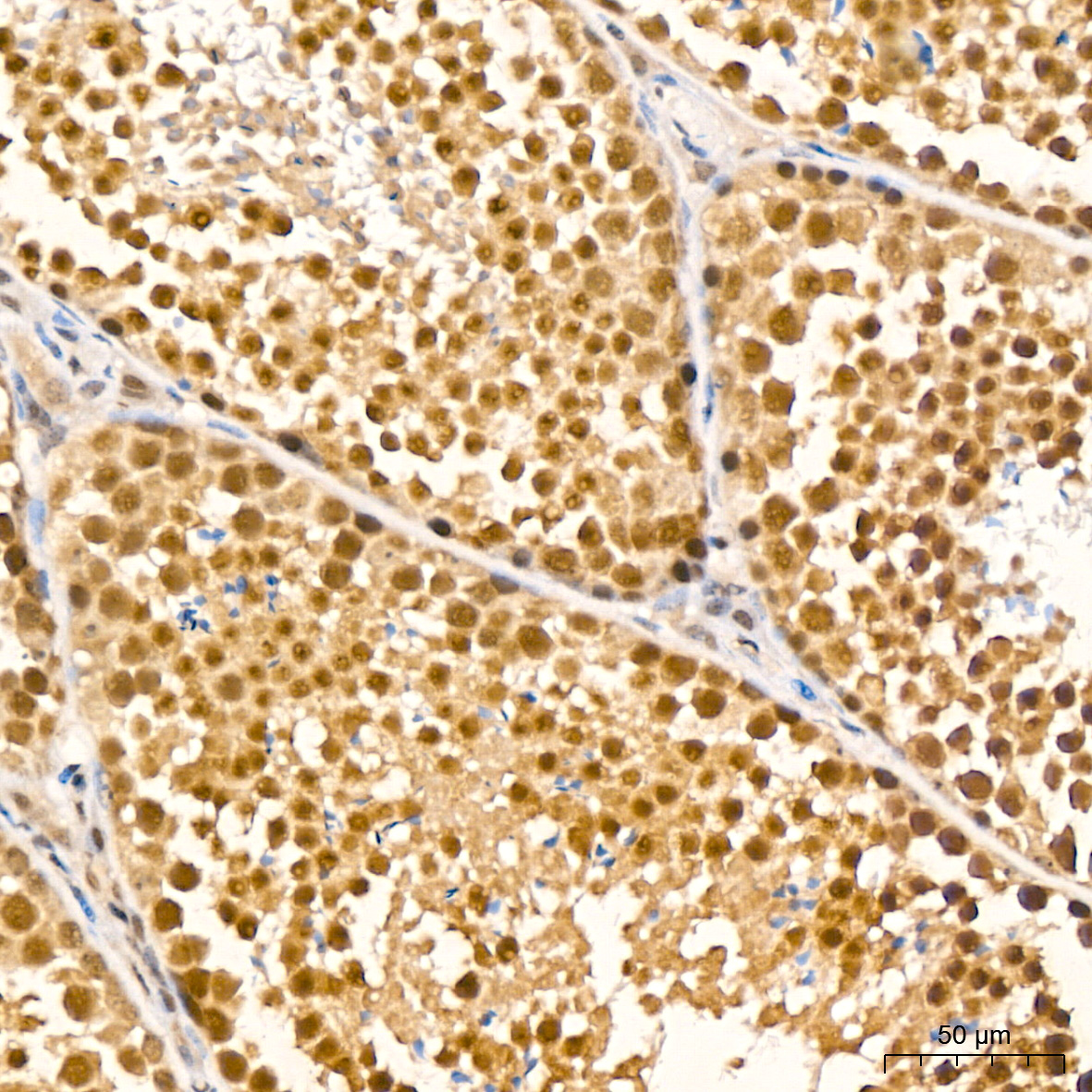 UBE2I Rabbit mAb