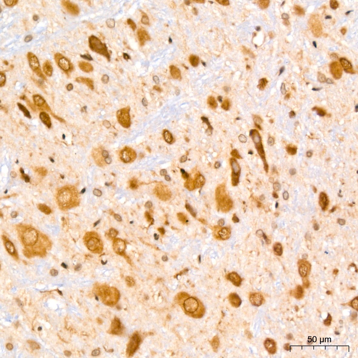 UBE2I Rabbit mAb