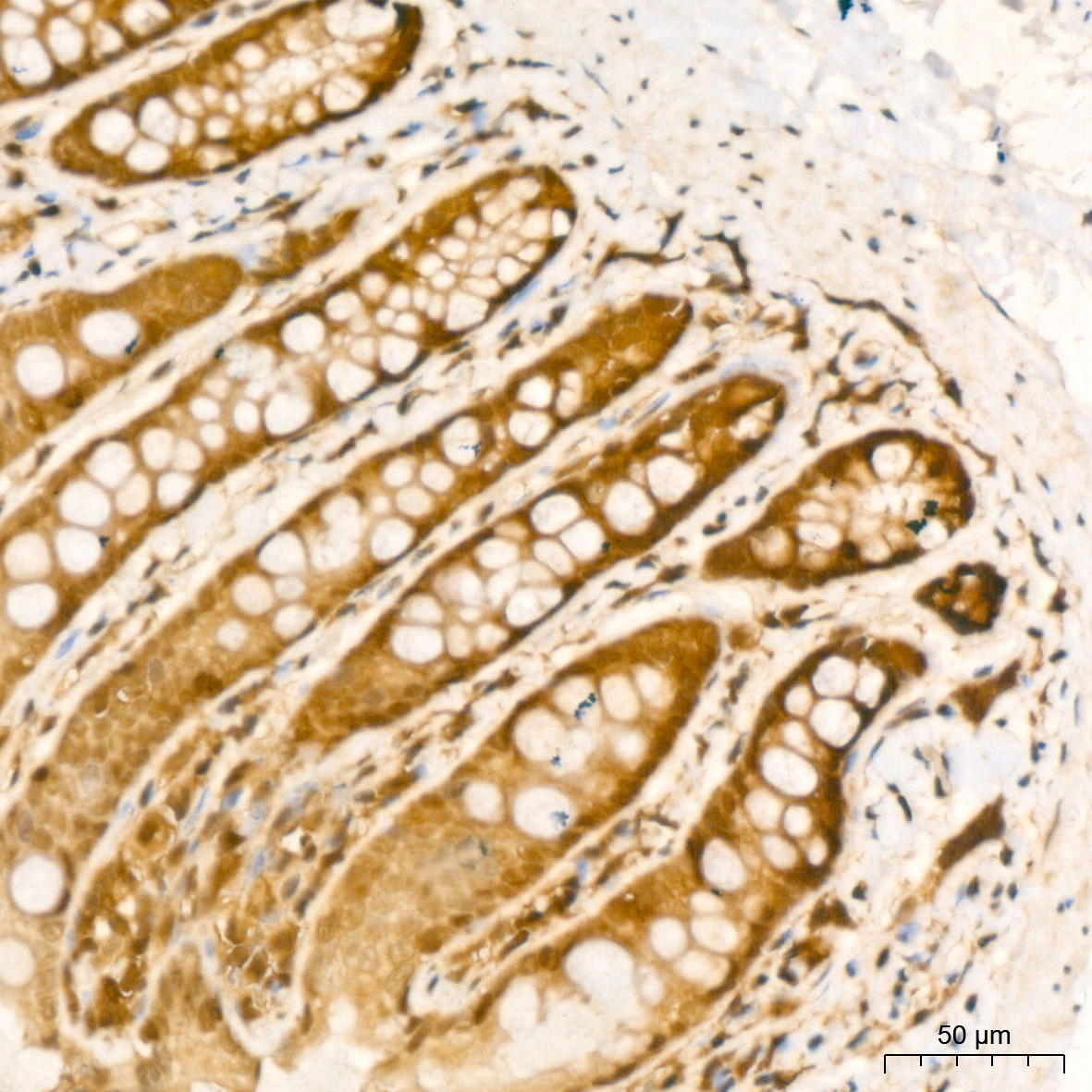 UBE2I Rabbit mAb