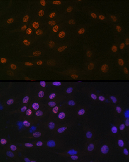 KAT1/HAT1 Rabbit mAb