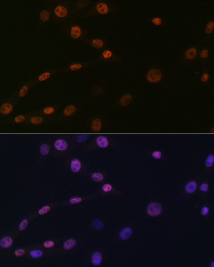 KAT1/HAT1 Rabbit mAb