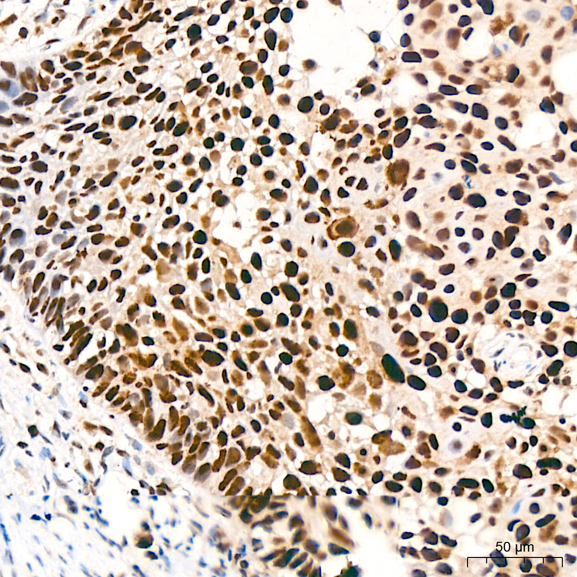 KAT1/HAT1 Rabbit mAb