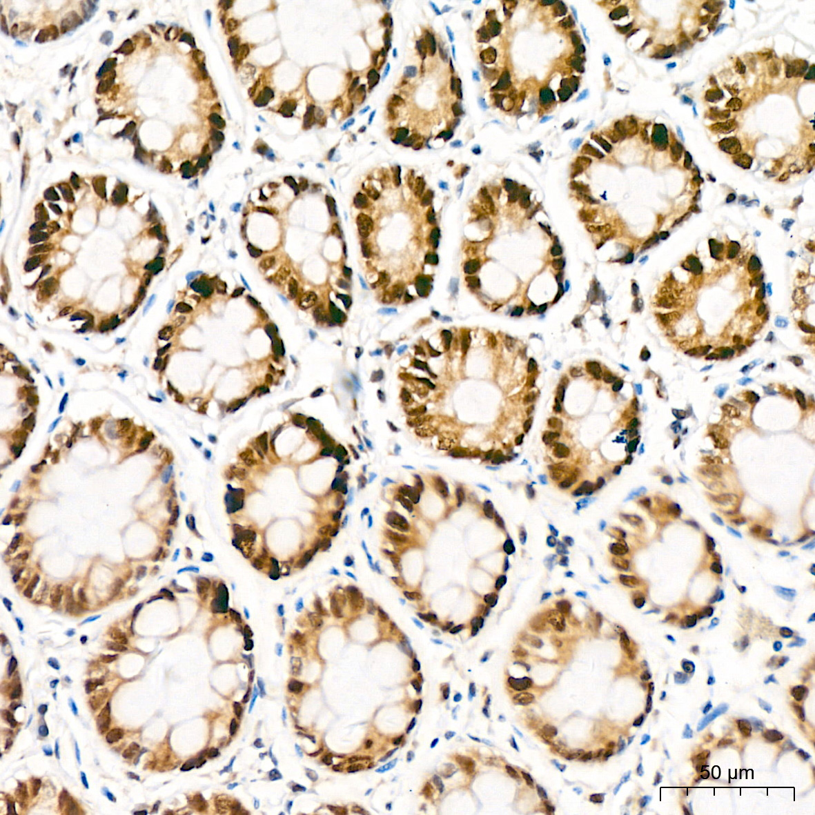 KAT1/HAT1 Rabbit mAb