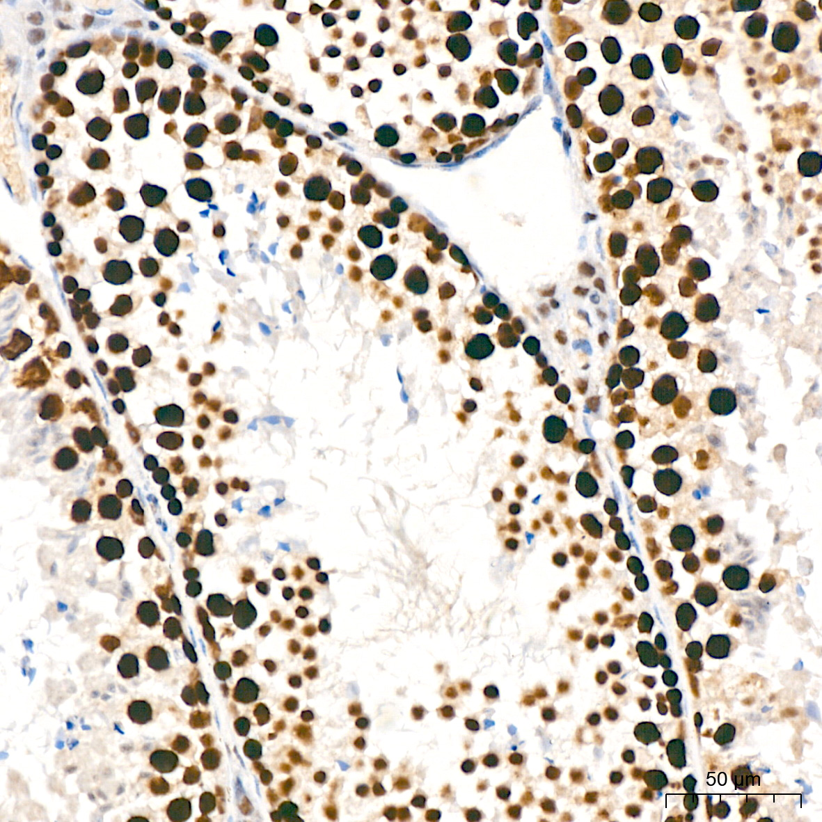 KAT1/HAT1 Rabbit mAb