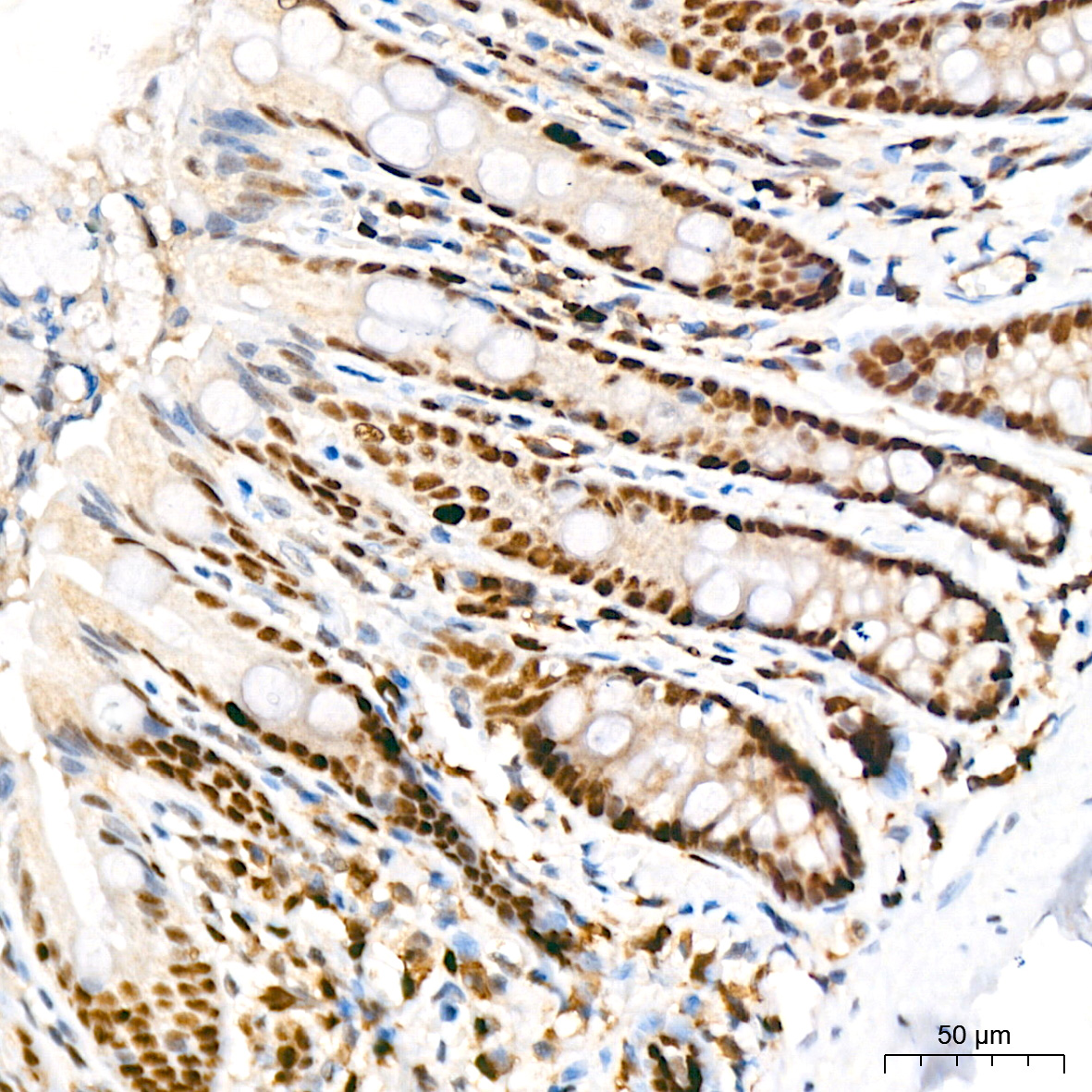 KAT1/HAT1 Rabbit mAb
