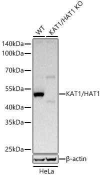 [KO Validated] KAT1/HAT1 Rabbit mAb