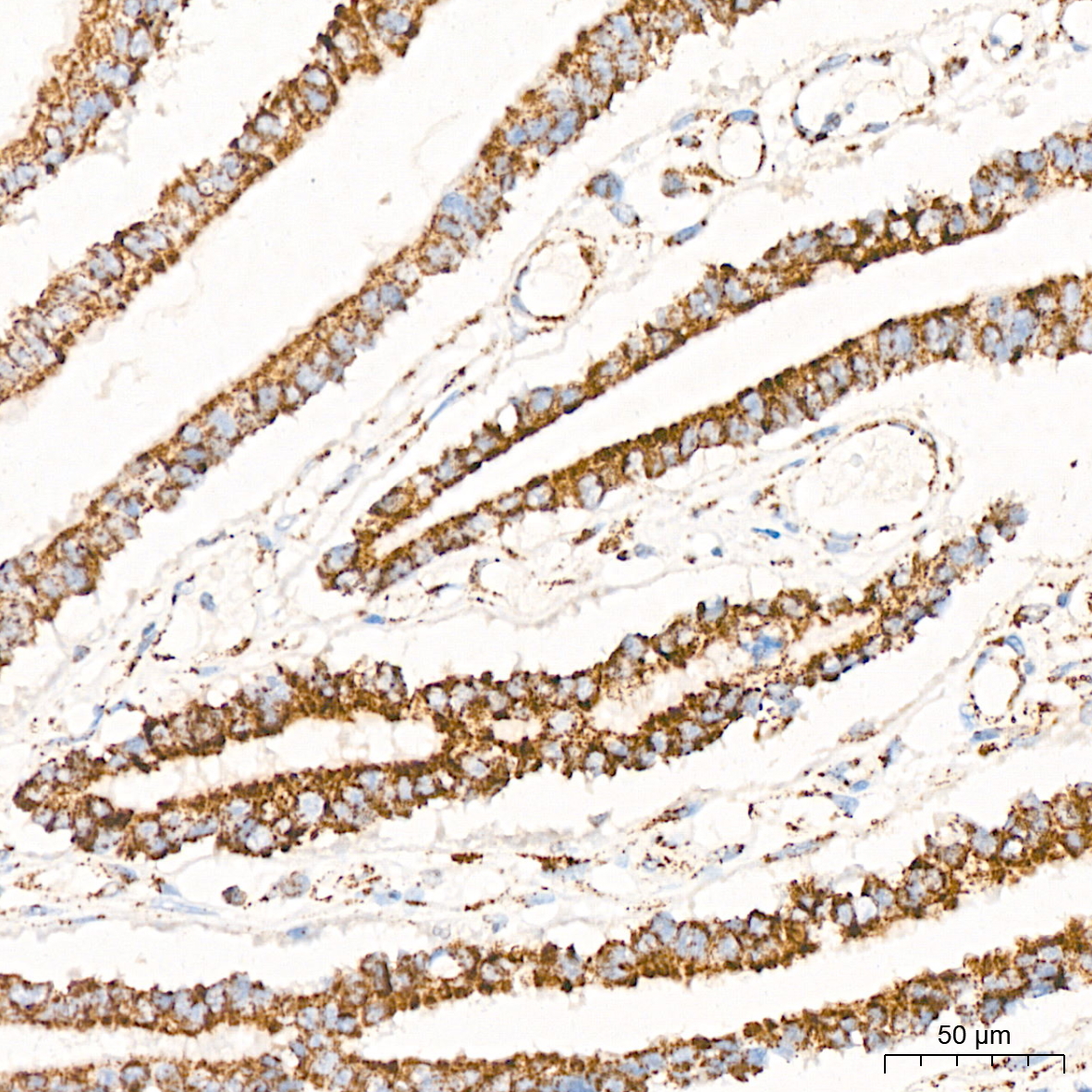 PDHB Rabbit mAb