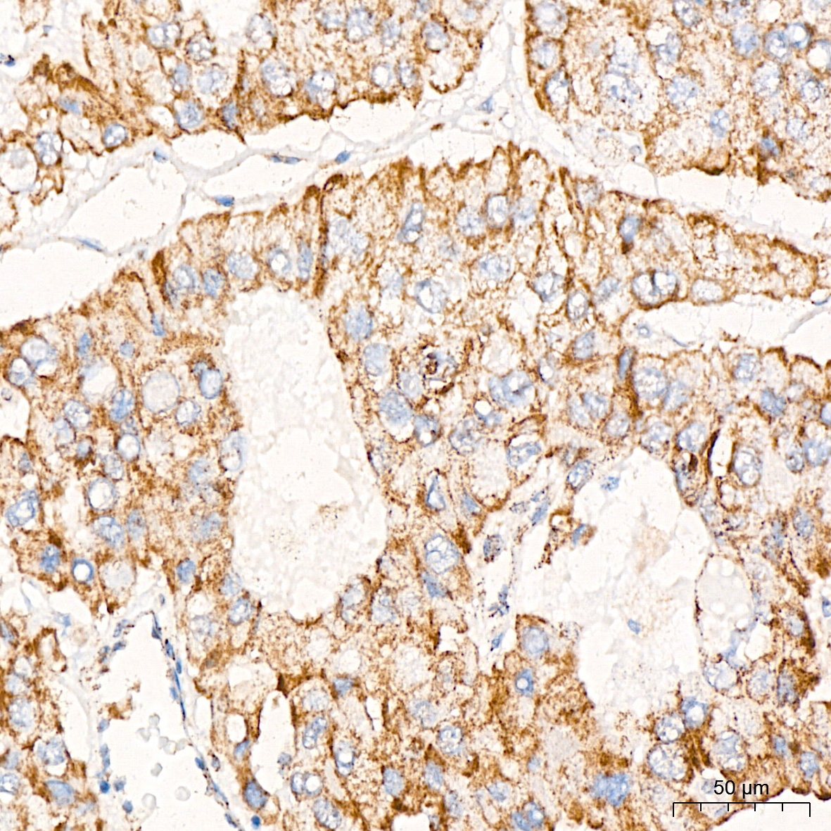 PDHB Rabbit mAb