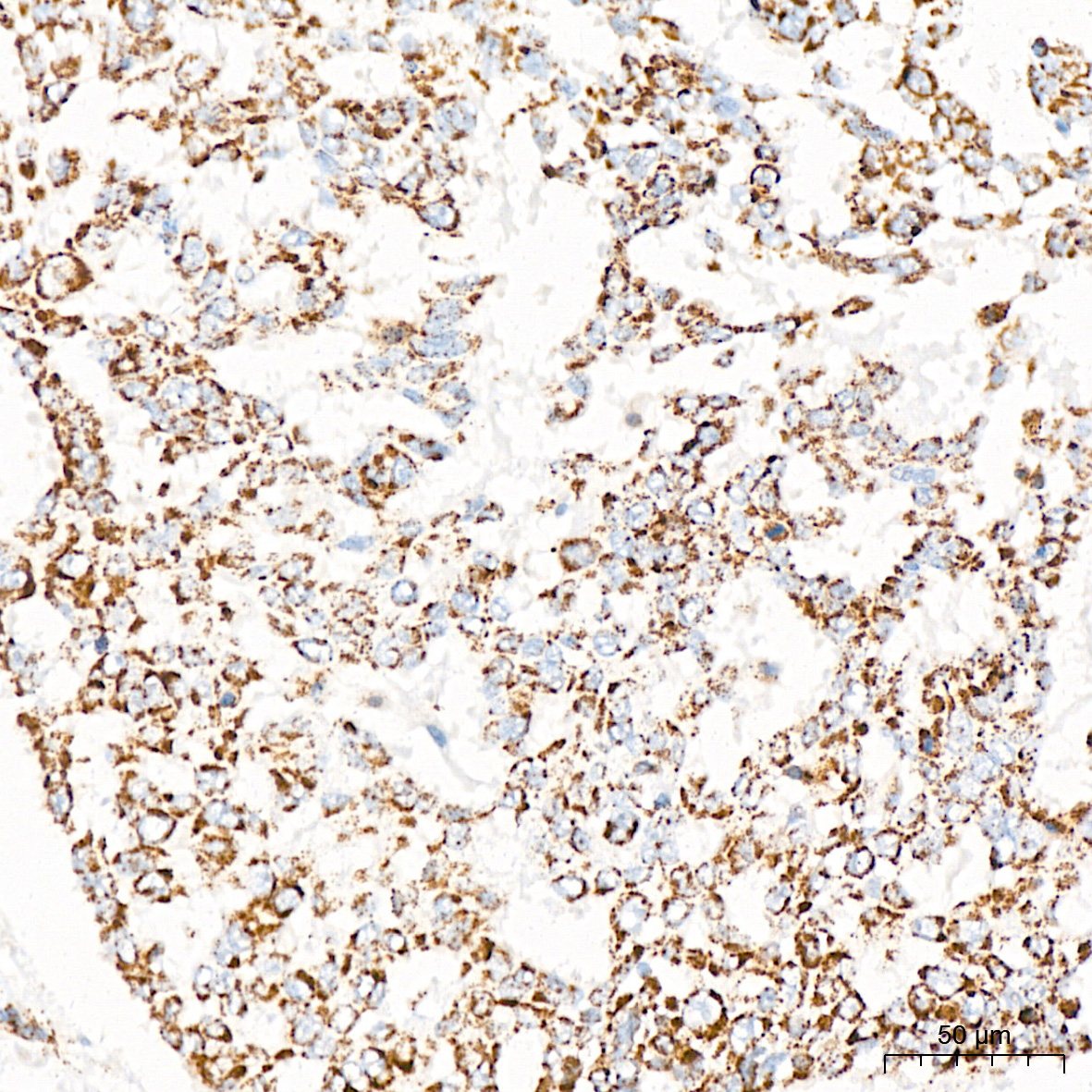 PDHB Rabbit mAb