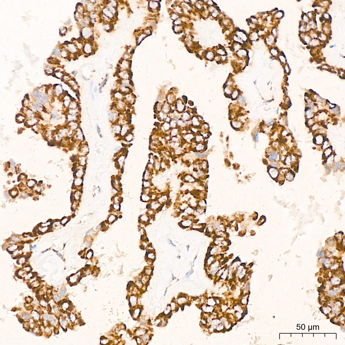PDHB Rabbit mAb