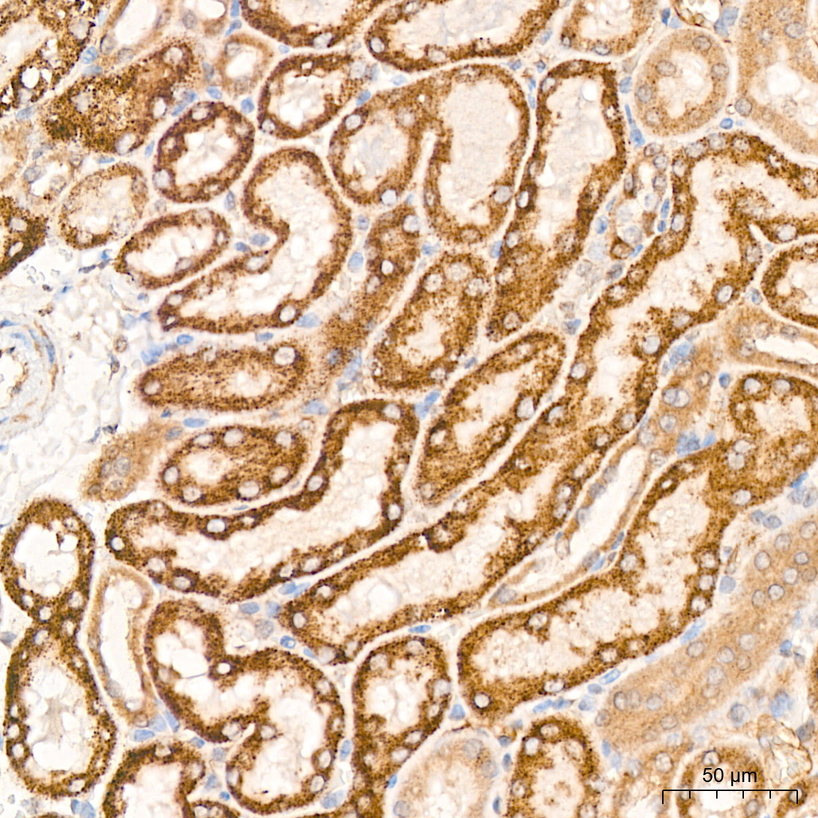 PDHB Rabbit mAb