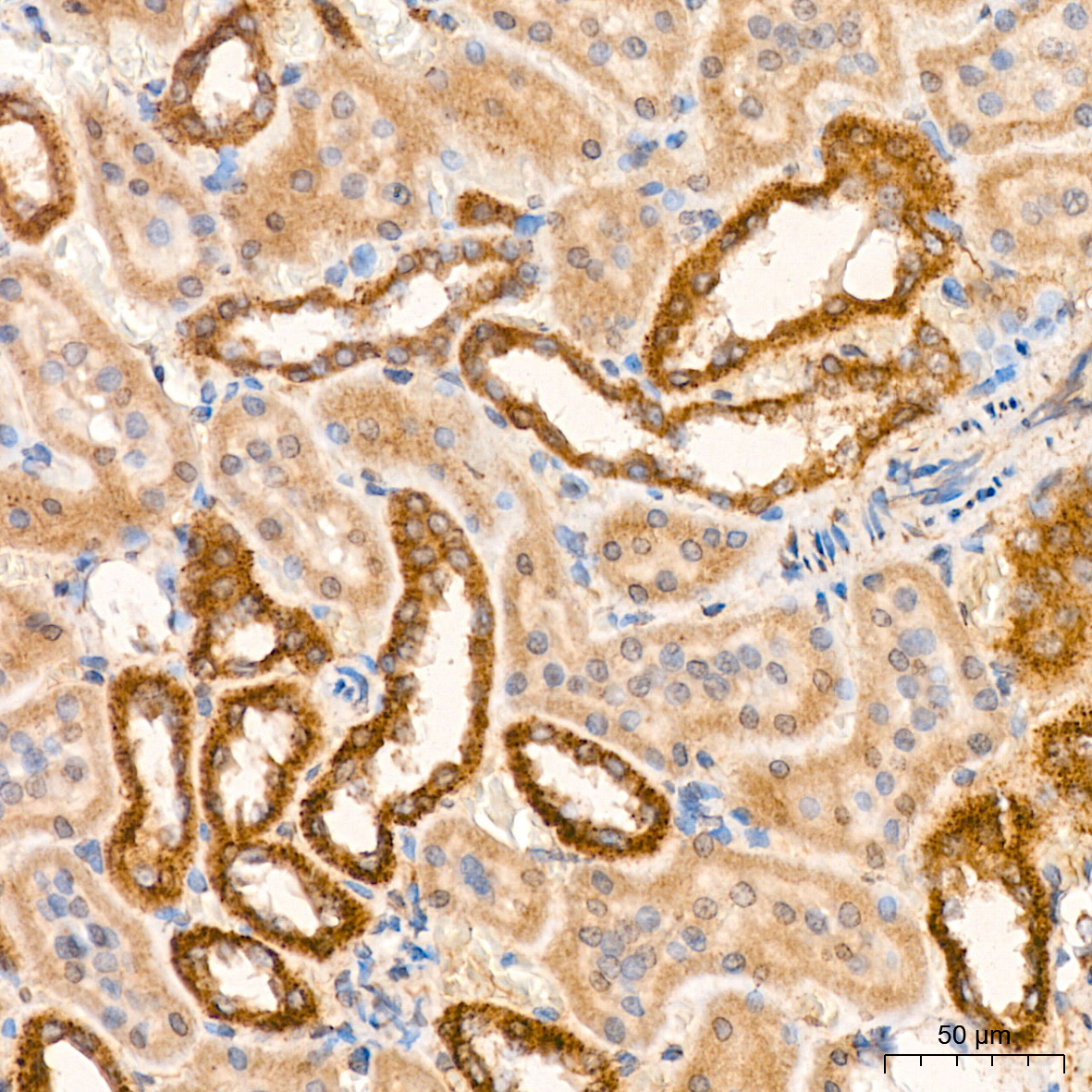 PDHB Rabbit mAb