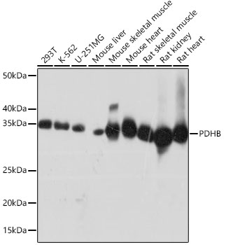 PDHB Rabbit mAb