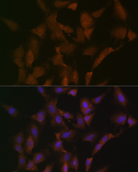 DISC1 Rabbit mAb