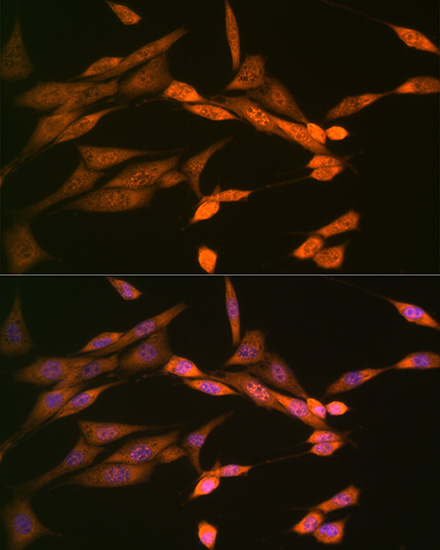 DISC1 Rabbit mAb