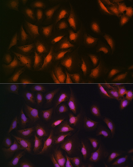 DISC1 Rabbit mAb