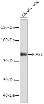 PIAS1 Rabbit mAb