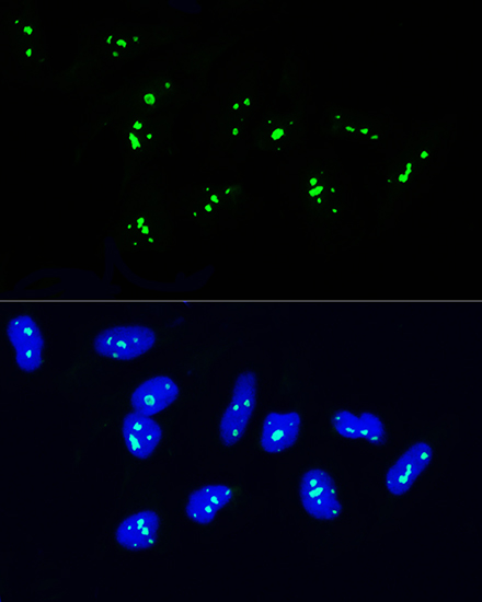 NOP58 Rabbit pAb
