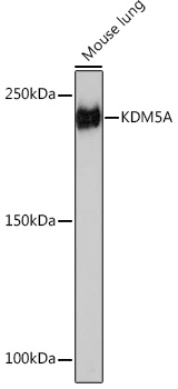 KDM5A Rabbit mAb