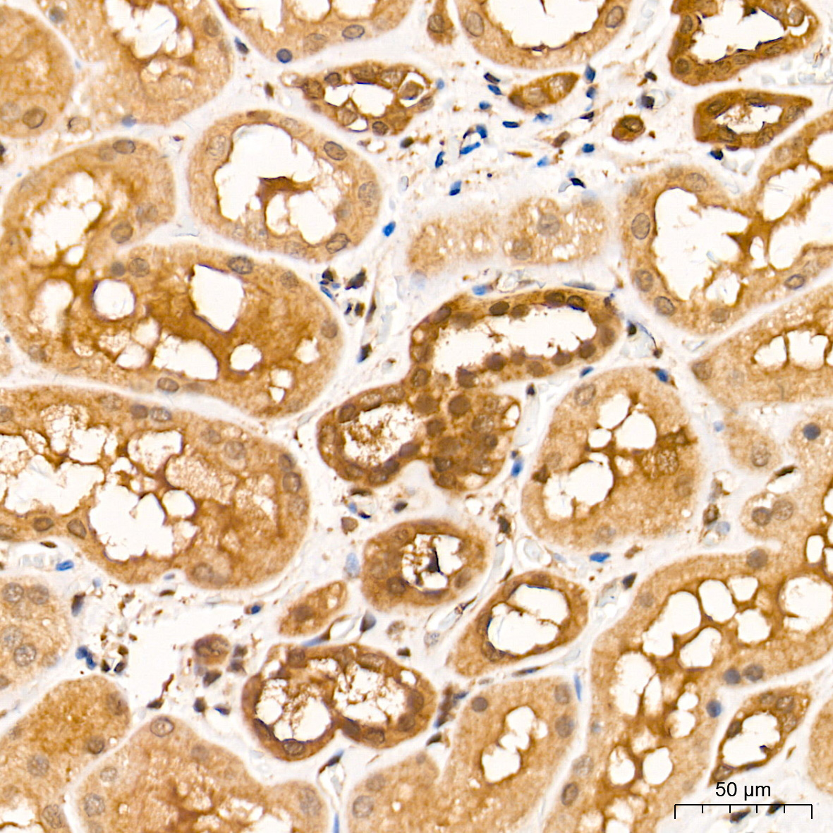 ERK1/2 Rabbit mAb